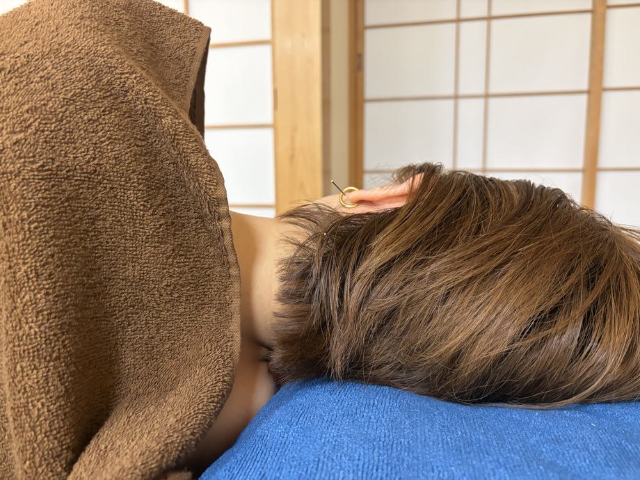 全身の状態を確認しながら行う鍼灸の施術風景